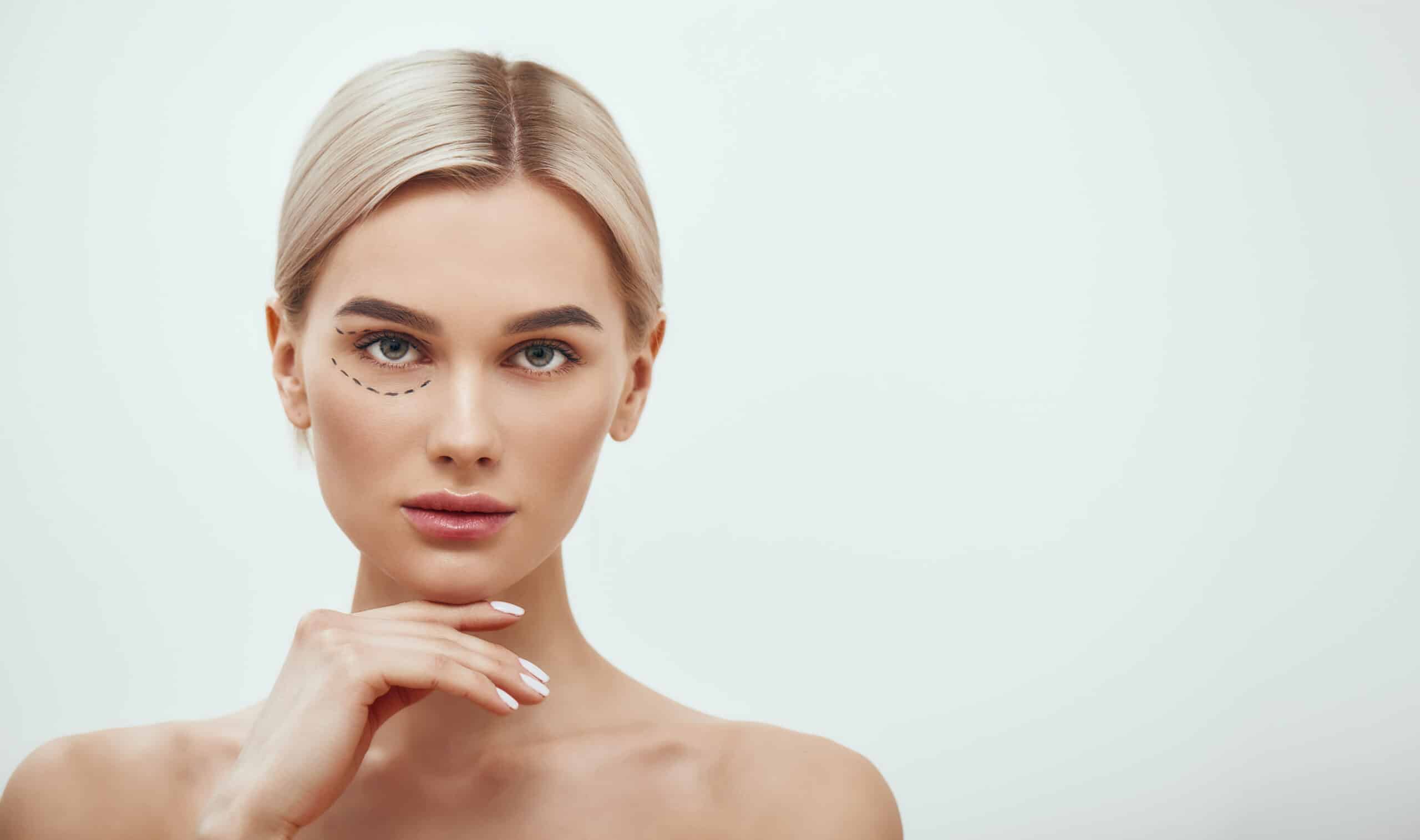 Perforation lines. Beautiful and young blonde woman with black surgical lines on eyelids and under eyes and looking at camera while standing against grey background Blepharoplasty Cosmetic and Medical Benefits