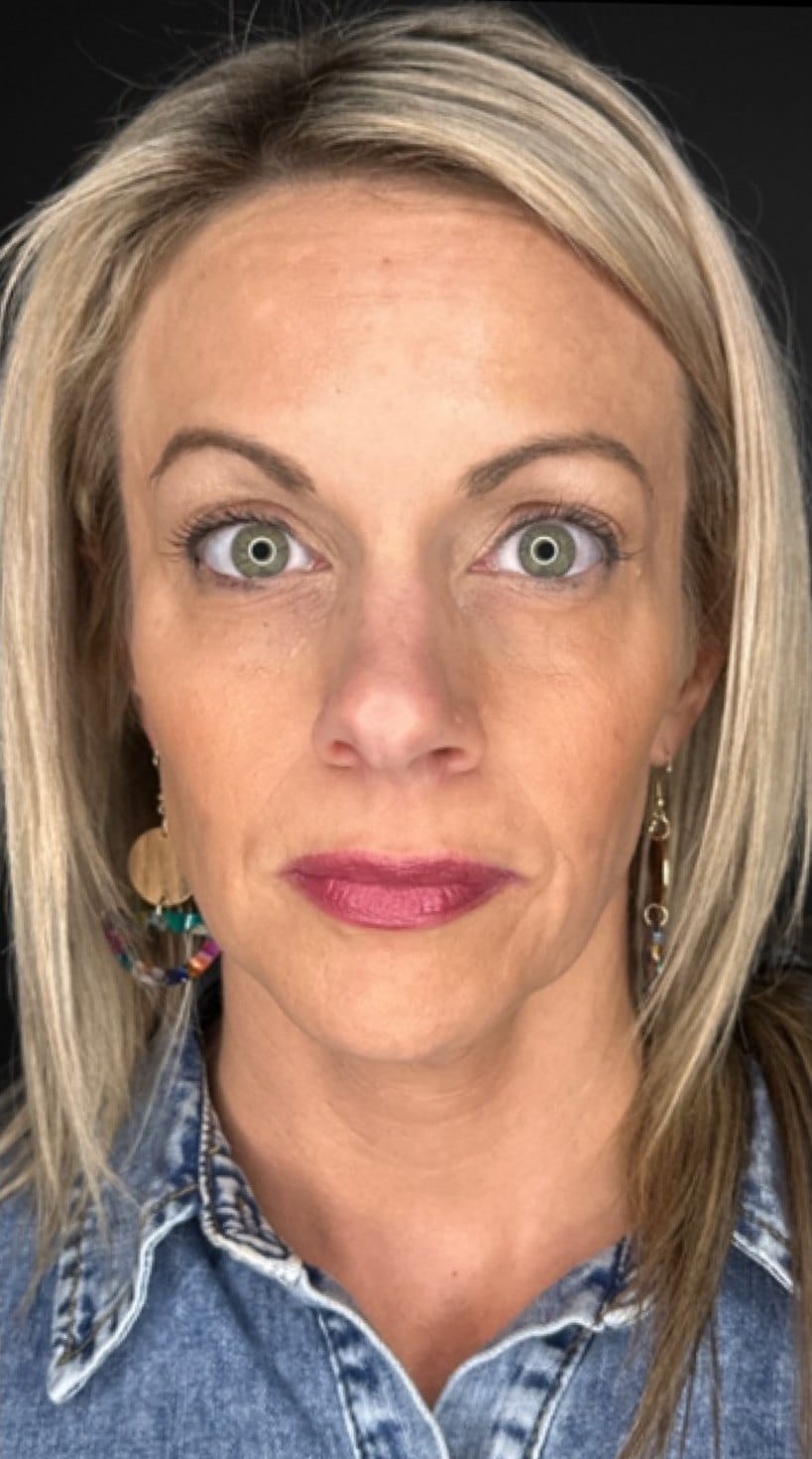 After Peptide Therapy Treatment At Anthony Aesthetics In St. Petersburg, Fl